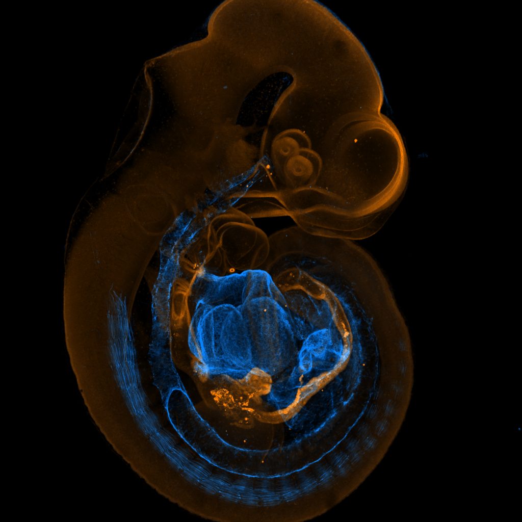 Mouse embryo imaged on Zeiss AxioZoom.v16 with Apotome.