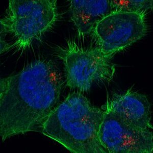 The Finnish Euro-Bioimaging Node receives significant funding