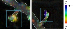 JNK Protein Triggers Nerve Cells to Withdraw Their Synapses when Stressed