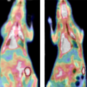 Westermarck Lab: a study revealed a new subtype of drug-sensitive ovarian cancer