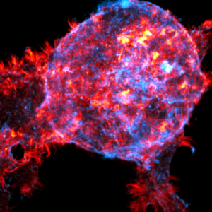 Sticky cell fingers help keep breast tumours contained