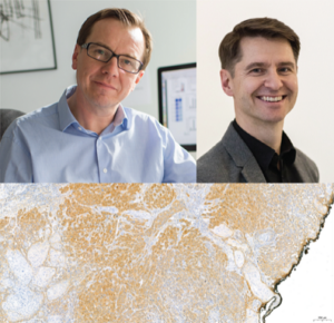 Novo Nordisk Fonden funding to Westermarck and Ventelä teams to develop new cancer biomarker for clinical use