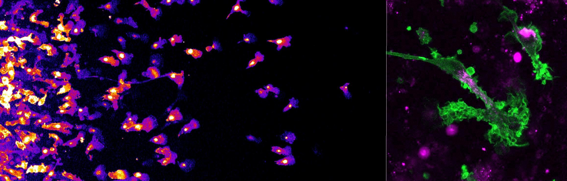 Immune Cell Navigation – Turku Bioscience Centre