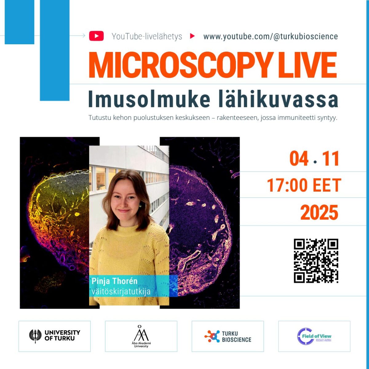 Microscopy Live: Imusolmuke lähikuvassa – tutustu kehon puolustuksen keskukseen, rakenteeseen, jossa immuniteetti saa alkunsa.
